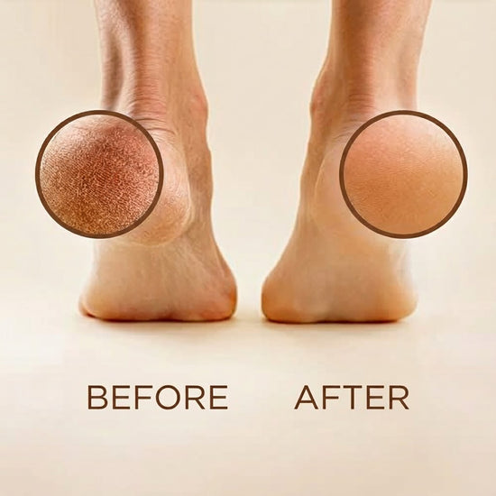 Zeep Naturals | Terracotta Foot Exfoliator | Zeep Naturals brings you handcrafted soaps, organic cotton towels, and artisan kitchen essentials — all inspired by nature. Discover simple, sustainable living with products designed to soothe your senses and your home.
